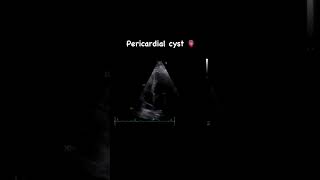 A pericardial cyst in echocardiography 💖 [upl. by Dlonyar450]