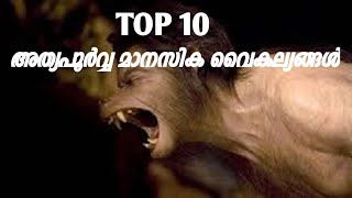 Top 10 Bizzare Mental Disorders പത്ത് വിചിത്ര മാനസിക വൈകല്യങ്ങൾ [upl. by Enyak169]