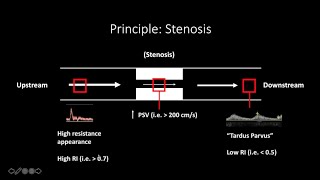 Doppler Ultrasound Part 1  Principles w focus on Spectral Waveforms [upl. by Azalea]