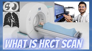 What is HRCT Scan  HRCT Chest scan explanation  एच आर सीटी स्कैन क्या होता है [upl. by Toblat]