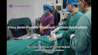 Microwave Ablation of Thyroid Nodules under Ultrasound Guidance [upl. by Ethelyn]