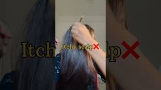 quotFix Itchy Scalp Simple Remedy That Work Wonder” 🌿shorts haircare hairgrowth [upl. by Nho]