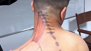 Levator scapulea muscle اهم عضلات متسببة فى الم الرقبة [upl. by Bausch]