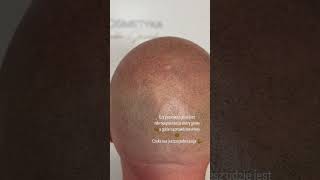 Mikropigmentacja skóry głowy lysine scalpmicropigmentation mikropigmentacja pigmentation barber [upl. by Brindle]