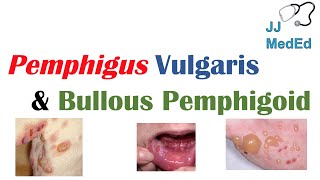 Vesiculobullous Skin Diseases  Pemphigus Vulgaris vs Bullous Pemphigoid [upl. by Norat]