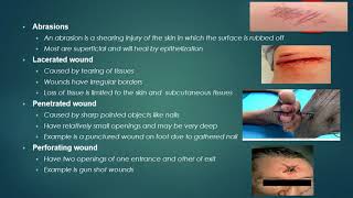 LEGAL MEDICINE LECTURE SERIES 7 MEDICOLEGAL ASPECTS OF PHYSICAL INJURIES [upl. by Jovi]