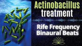 Actinobacillus treatment  Healing Rife Frequency  Binaural Beats [upl. by Hilario163]