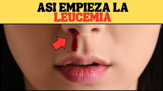 Que es la LEUCEMIA Causas Sintomas y Tratamiento [upl. by Amikan643]