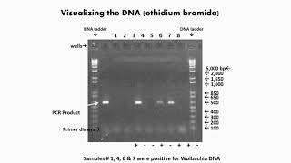 Visualization of Gel Electrophoresis [upl. by Charlena835]