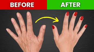 1 Top Remedy for Dry and Wrinkled Hands and Skin [upl. by Novia]