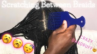 ASMR Scratching Between Braids With A Comb  No Talking  ASMR Sounds [upl. by Ariek107]