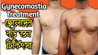 Gynecomastia  ছেলেদের বড় স্তন ছোট করার চিকিৎসা [upl. by Annawaj305]