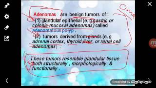 Pathology Neoplasia part1 [upl. by Etteniotnna]