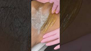 SUGARING  SUGAR WAX waxing hairremoval sugarwaxing sugarwax [upl. by Diann]