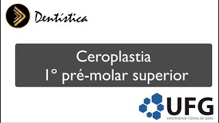 Ceroplastia 1º Pré molar superior [upl. by Uyekawa]