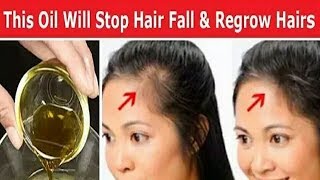 100 Effective  ये है वो जादुई तेल जो गंजे सिर पर फिर से उगा सकती हैं बाल  hair growthhair fall [upl. by Nosirrag402]