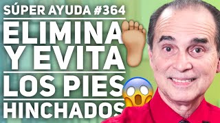 SÚPER AYUDA 364 Cómo Eliminar Y Evitar Los Pies Hinchados [upl. by Mikihisa]