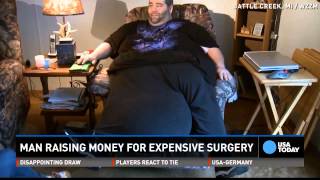 Man with 100lb scrotum was told to lose weight [upl. by Reed625]