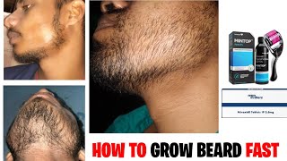 दाढ़ी जल्दी उगाने का सबसे अच्छा और आसान तरीका  minoxidil beard growth dermaroller for beard growth [upl. by Arias878]