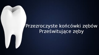 Przezroczyste i prześwitujące końcówki zębów [upl. by Niraj708]