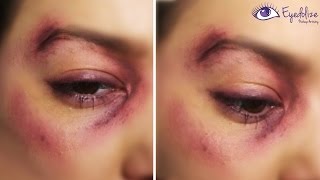 I Got Punched Bruised Black Eye Makeup Tutorial by EyedolizeMakeup [upl. by Dennis]