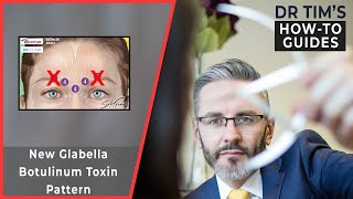 New Glabella Botulinum Toxin Pattern [upl. by Anar27]