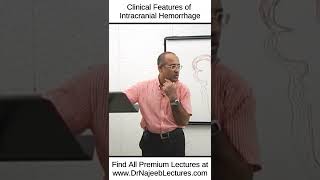 Clinical Features Of Intracranial Haemorrhages shortvideo shorts drnajeeb drnajeeblectures [upl. by Maretz]