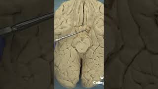 Uncus of parahippocampal gyrus neuroanatomy limbicsystem cortex forebrainmedicaleducation [upl. by Darda]