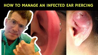 How to recognise manage and treat an infected ear piercing  Doctor ODonovan explains [upl. by Nevear]