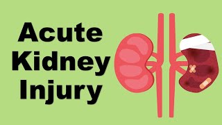 Acute Kidney Injury AKI  causes and management [upl. by Accebar]