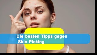 Die besten Tipps gegen Skin Picking [upl. by Donnelly]