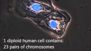 A microscopic view of a buccal swab sample for DNA analysis [upl. by Toffey]