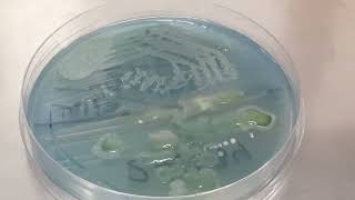 Lactose fermenting colonies of Raoultella ornithinolytica became Nonlactose fermenting after old [upl. by Onaireves938]