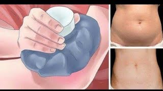 How To Get Rid Of Belly Fat  របៀបសម្រកខ្លាញ់ក្បាលពោះ [upl. by Irfan759]