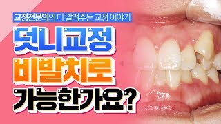 덧니 교정은 꼭 발치교정을 해야하나요 비발치 도 가능할까요 [upl. by Clifton]