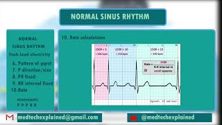 ECG FAST TRACK part 17 Normal sinus rhythm 2 [upl. by Nolly]