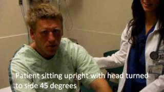 Hallpike Test and Epley Maneuver [upl. by Kendry302]