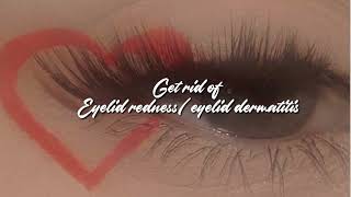 ༻✧ Get rid of eyelid dermatitis eyelid redness✧ ༻ [upl. by Breger]