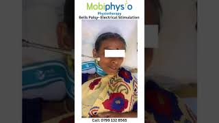 Bells Palsy Treatment  Physiotherapy  Electrical stimulation bellspalsy stimulation mobiphysio [upl. by Mellisa903]