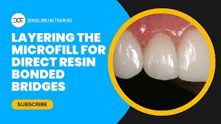 Layering the Microfill for Direct Resin Bonded Bridge with Dr Dennis Hartlieb  DOT Course Clip [upl. by Aicirt]