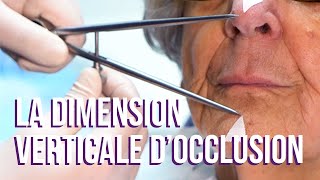 Tuto Prothèse 2 – La dimension verticale d’occlusion [upl. by Ayita330]