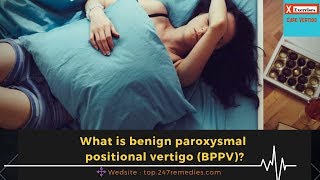 Vertigo Exercises  What is Benign Paroxysmal Positional Vertigo BPPV [upl. by Lenroc]