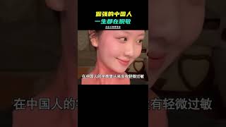 中国人的字典里就没有轻微过敏！ 搞笑 离谱 [upl. by Tarrel]