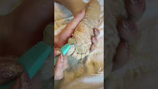 Full foot callus removal  Epidermolytic Palmoplantar Keratoderma  Jan 30 2023 [upl. by Kra31]