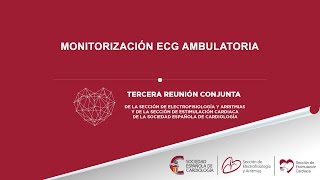 Monitorización ECG ambulatoria [upl. by Onailimixam]