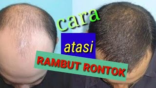 TOP TRENDING VIDEO cara mengatasi RAMBUT RONTOK [upl. by Shelman]