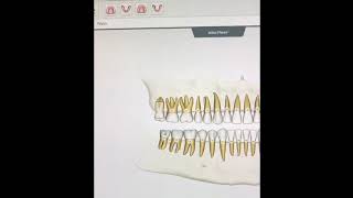 Odontogram Part 1 [upl. by Domella]