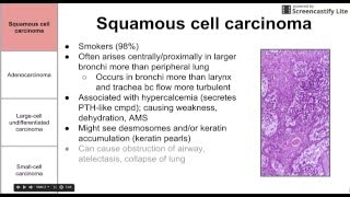 Cancers of the lung [upl. by Natye53]