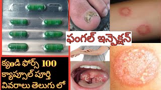 CANDIFORCE 100 CAPSULE FULL REVIEW IN TELUGU BEST MEDICINE TO TREAT FUNGAL INFECTION AND ITCHING [upl. by Lovering481]