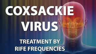 Coxsackie Virus  RIFE Frequencies Treatment  Energy amp Quantum Medicine with Bioresonance [upl. by Inail]